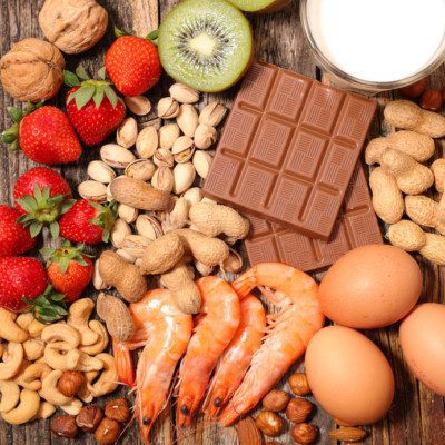 Nuts, fruit, milk, eggs and shellfish are a few common allergens.