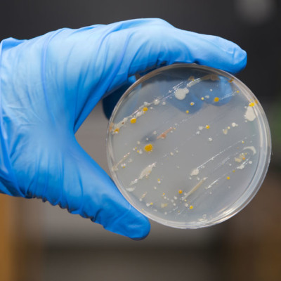 微生物控制程序在控制食物中的致病微生物中起着关键作用。